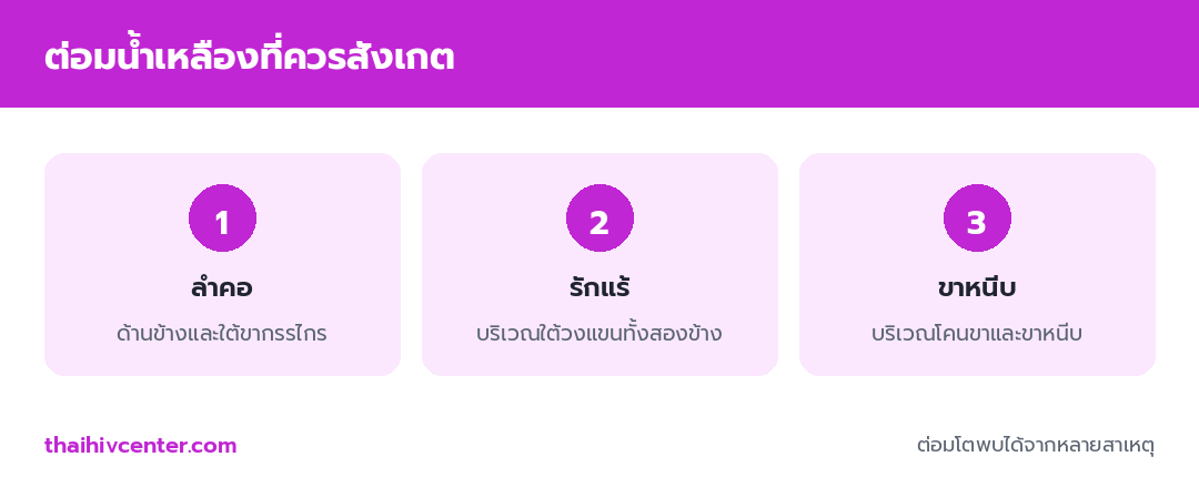 อินโฟกราฟิกต่อมน้ำเหลืองที่ควรสังเกต ได้แก่ ลำคอ รักแร้ และขาหนีบ